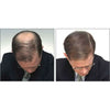 caboki hair loss treatment light brown